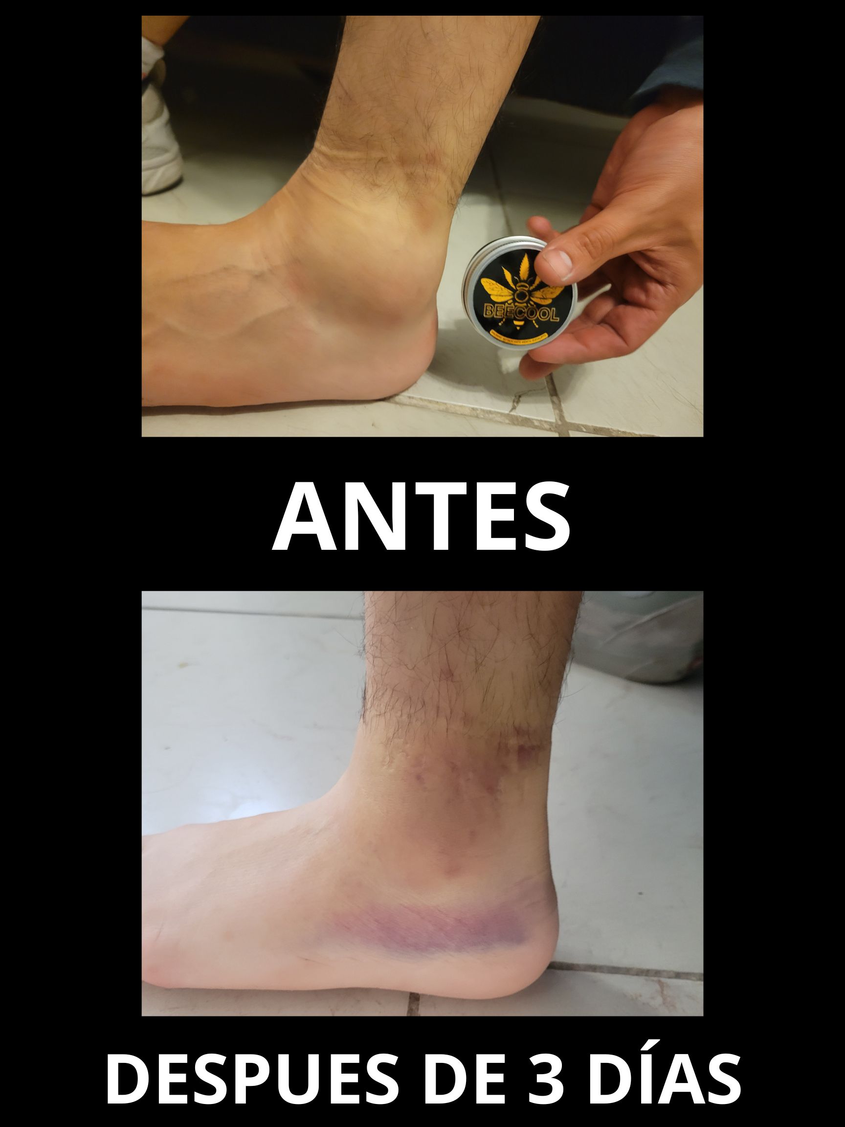 Antes y Después de usar Beecool - Resultados en 3 días